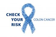 check your colon cancer risk