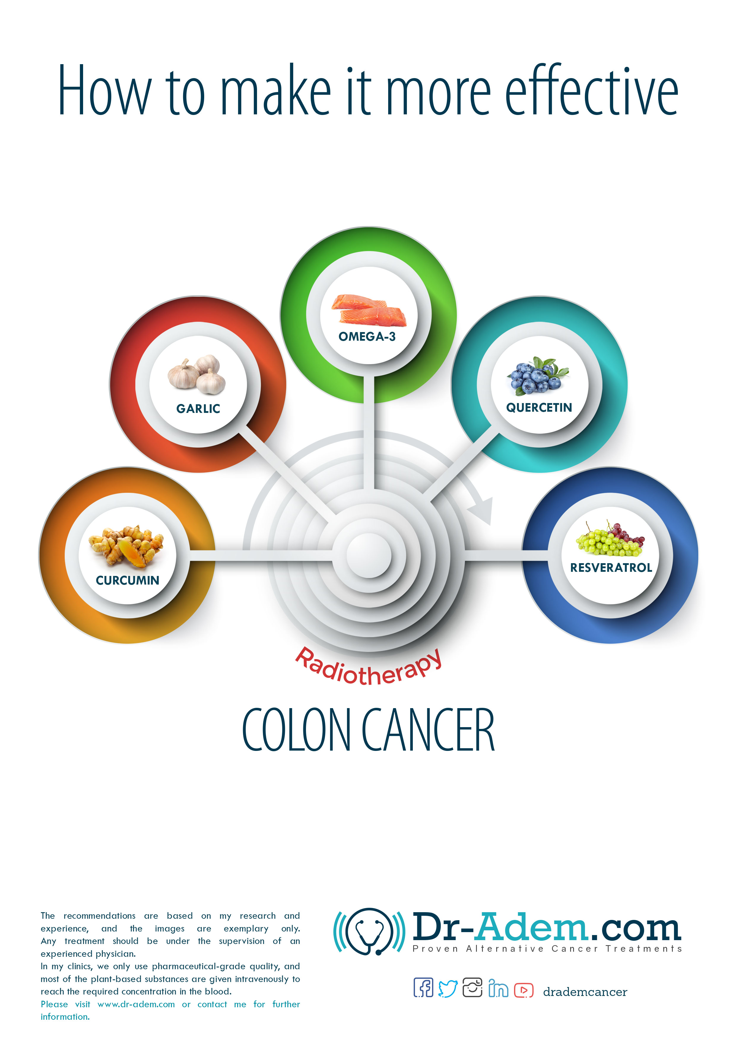 Radiotherapy For Colon Cancer