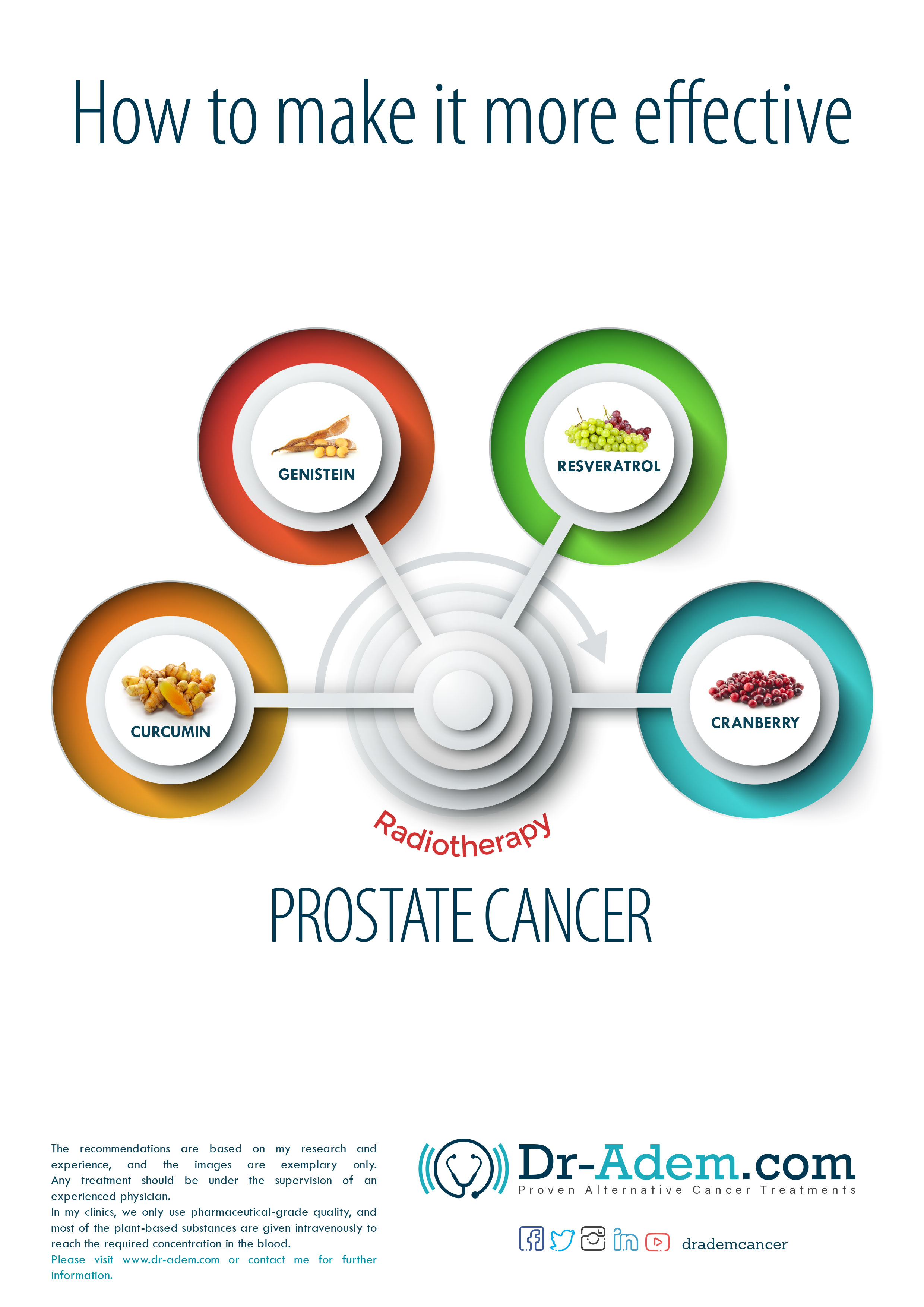 Radiotherapy For Prostate Cancer