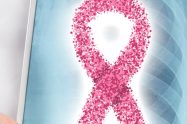 Everything You Need To Know About Breast Cancer